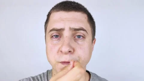 Close-up of a man who is crying. A tear runs down his cheek, and the guy wipes i Video stock 155406710