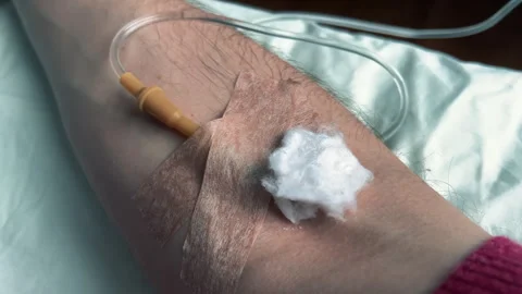 Close-up of a man's arm with an IV needle in the median cubital vein in a clinic Stock Footage 262565020