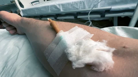 Close-up of a man's arm with an IV needle in the median cubital vein in a clinic Stock Footage 263165616