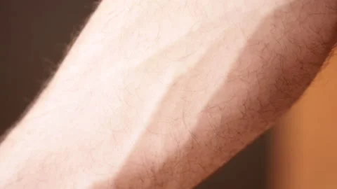 Close up of man's arm veins Stock Footage 134335551