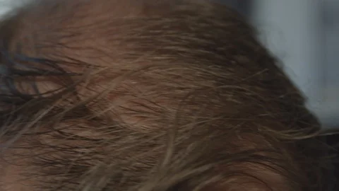 Close up of a man's balding head Stock Footage 122085324