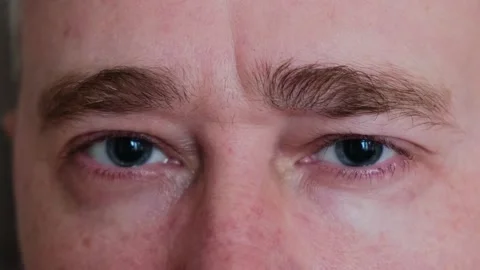 Close-up of a man's gray eyes with dilated big pupils. Stock Footage 274568997