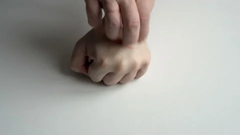 Close-up of a man's hand with dermatitis and psoriasis. A man scratches a wound Stock Footage 149439524
