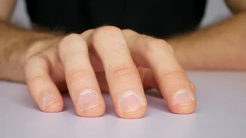 Close up of mans hand on a white table drumming on it with the fingers nervously Stock Footage 141100282