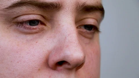 Close-up of a man's nose. Black dots and enlarged pores are clearly visible. Mac Stock Footage 123075414