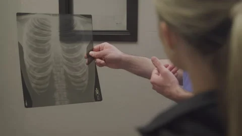 Close up of Medical Professional Arms Explaining X Ray to Blonde Patient Stock Footage 208792337