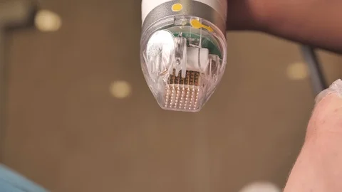 Close-up. Microneedle RF lifting device slightly rotating in a doctor's hand on Stock Footage 124321122