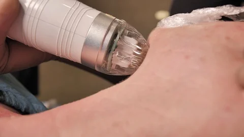 Close-up. microneedle RF lifting procedure. Hardware cosmetology. Beautician Video stock 124364191