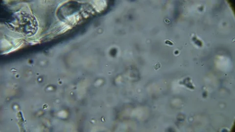 Close-up microscopic footage of a probiotic with visible crystals and diges.. Stock Footage 273478714