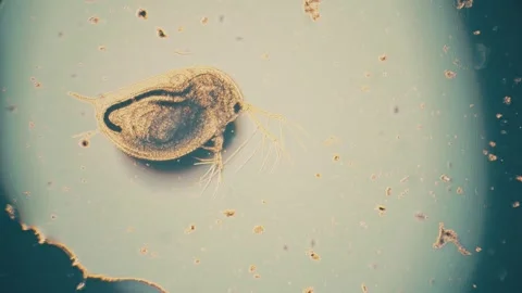 Close-Up Microscopic View of a Tiny Aquatic Organism in Natural Habitat Stock Footage 341926009