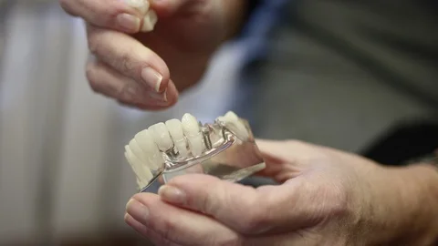 Close up of model as dentist uses it to explain a dental bridge Stock Footage 113724600