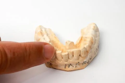 Close up of a mold of a man’s lower teeth Stock Photos