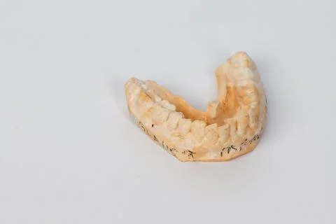 Close up of a mold of a man’s lower teeth Stock Photos