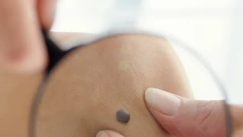 Close up of a mole Stock Footage 301497723