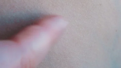 Close up of mole on human skin Stock Footage
