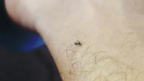 Close up of Mosquito Biting Human Skin and Sucking Blood Stock Footage 330574241