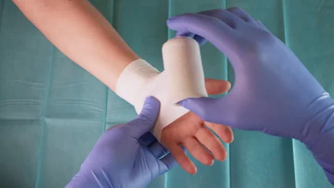 Close-Up of a Nurse Wrapping a Wrist with a Compression Bandage Stockbeeldmateriaal 338187160