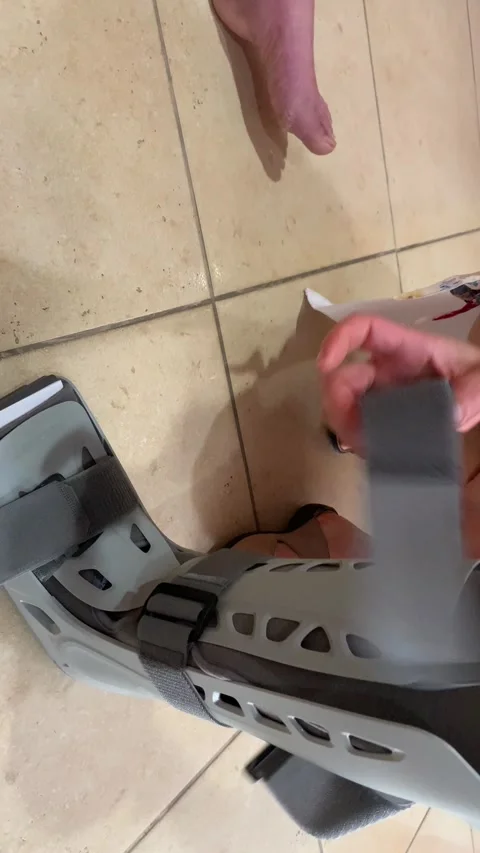 Close-up of a nurse's hands teaching a patient how to put on an orthopedic boot. Stock Footage 242486907