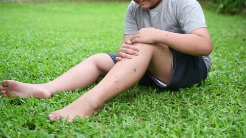 Close up obese boy having knee pain and massage knee Stock Footage 136183356