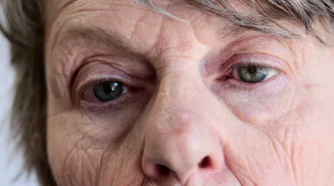 Close up of old woman's face, startled look and rapid blinking Stock Footage 54206945