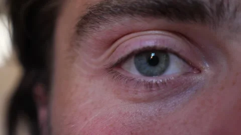Close-Up of One Eye Opening Stock Footage 295141653