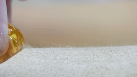 Close-up of one of the stages of the procedure for removing hair on the legs Stock Footage 118705559