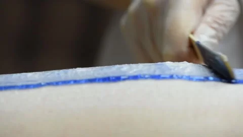 Close-up of one of the stages of the procedure for removing hair on the legs 스톡 동영상 153584259