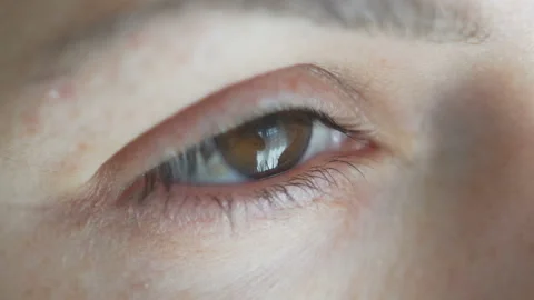Close-up opening brown female eye. squints from the light Stock Footage 106960596