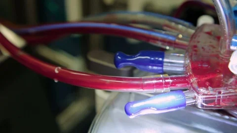 Close-up operating the heart-lung machine with tubes and flaps which runs the Stock Footage 74214134