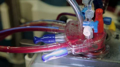 Close-up operating the heart-lung machine with tubes and flaps which runs the Stock Footage 74214194