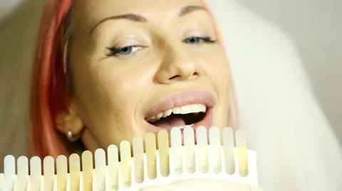 Close-up of palette for tooth color, color matching, Choice of color of a dental Stock Footage 59643790