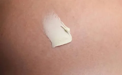 Close-up of a patch of cream on human skin 写真素材