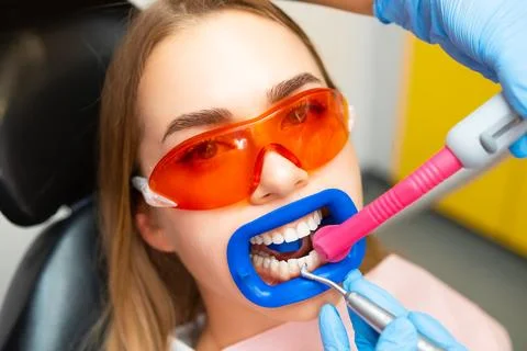 Close up a patient while doing a professional teeth cleaning procedure at the Stock Photos