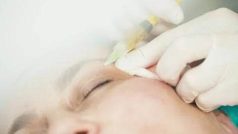 Close-up of the patient's face during plasma therapy. Video stock 274066098