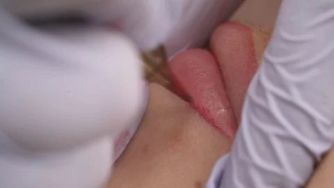 Close-up of patients lips during the procedure of lip blushing with tattoo Stock Footage 113495994