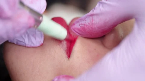Close up of patients lips during the procedure of lip blushing with tattoo ma Stock Footage 164057218