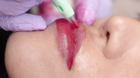 Close up of patients lips during the procedure of lip blushing with tattoo ma Stock Footage 164057405