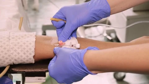 Close-up. Peripheral venous catheter insertion in operation room. medicine Stock Footage 138212103
