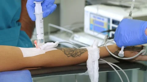 Close-up, peripheral venous catheter is installed on patient's arm. doctor or Stock Footage 138274943