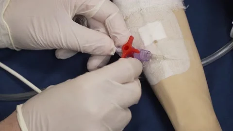 Close-up, a peripheral venous catheter is installed on simulation doll hand 库存影片 142606013
