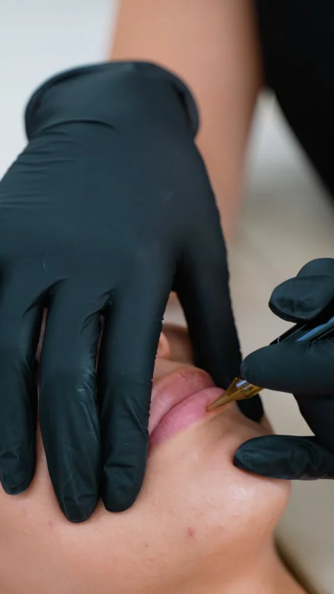 Close-Up of Permanent Lip Makeup Procedure by Skilled Artist Stock Footage 286278212