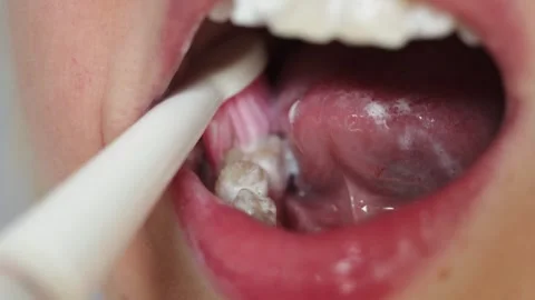 Close-up of person brushing their tongue with a toothbrush for oral hygiene Stock Footage 340261367