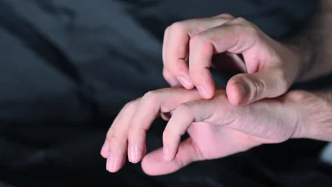 Close Up of Person Scratching Hand Due to Skin Irritation or Itching Stock Footage 337785108