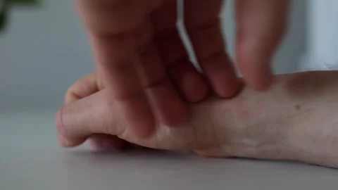 A close-up of a person scratching their hand, revealing red, irritated skin with Stock Footage 304623280