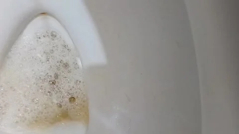 Close up of person urinating in a white ceramic toilet bowl 스톡 동영상 335019632