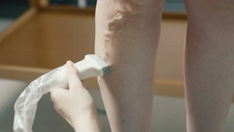 Close up of person using vein surgery scan device Video stock 270532772