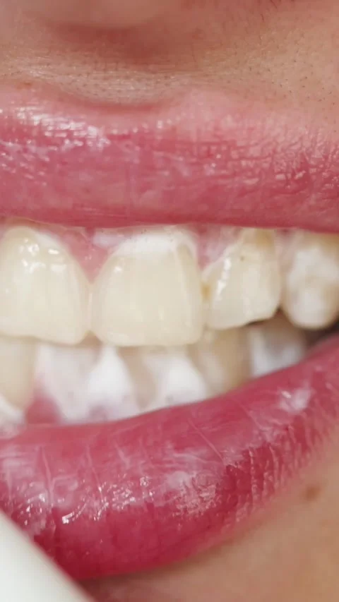 Close up of a person's mouth with toothpaste foam on teeth and lips Vidéo 343838162