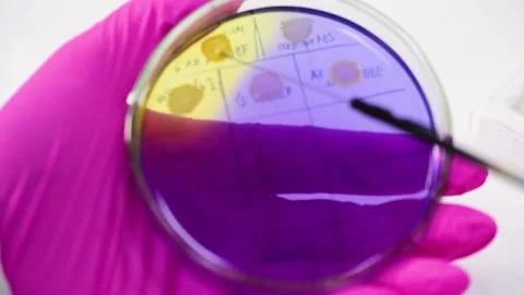 Close-up of a petri dish with colonies of bacteria in the hands of a researcher. Stock-Footage 148282680