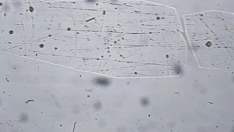 Close up of photo of virus under microscope on computer monitor screen on Stock Footage 160111551