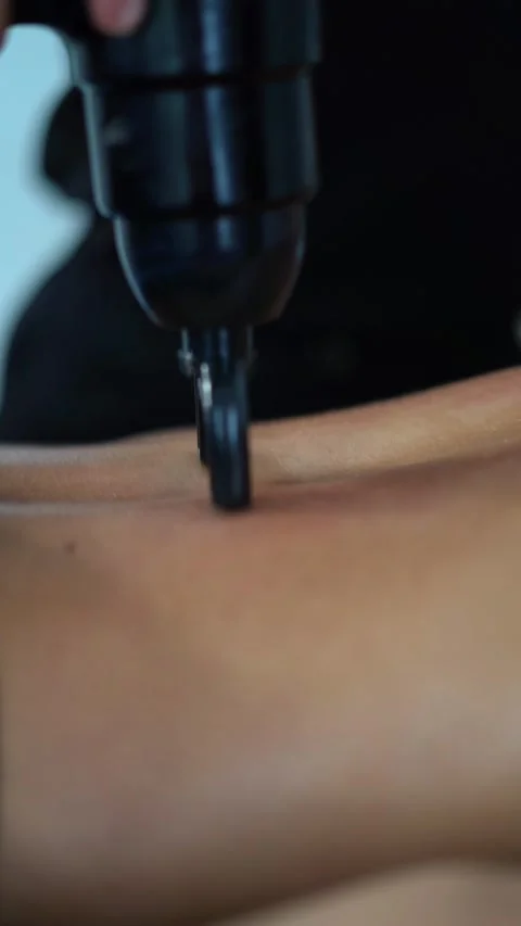 Close Up Of Physiotherapist Treating Lower Back Pain With Electronic Massage Dev Stock Footage 332658308